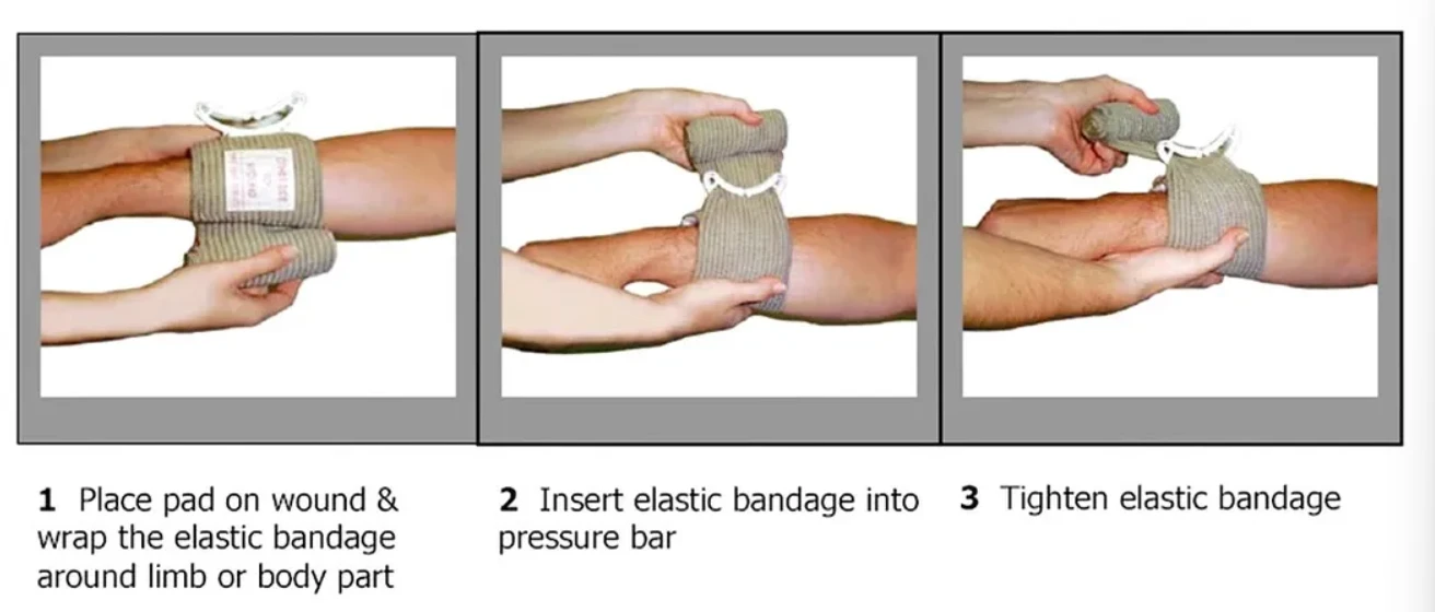 Emergency Compression Bandage USAGE Emergency Compression Bandage USAGE