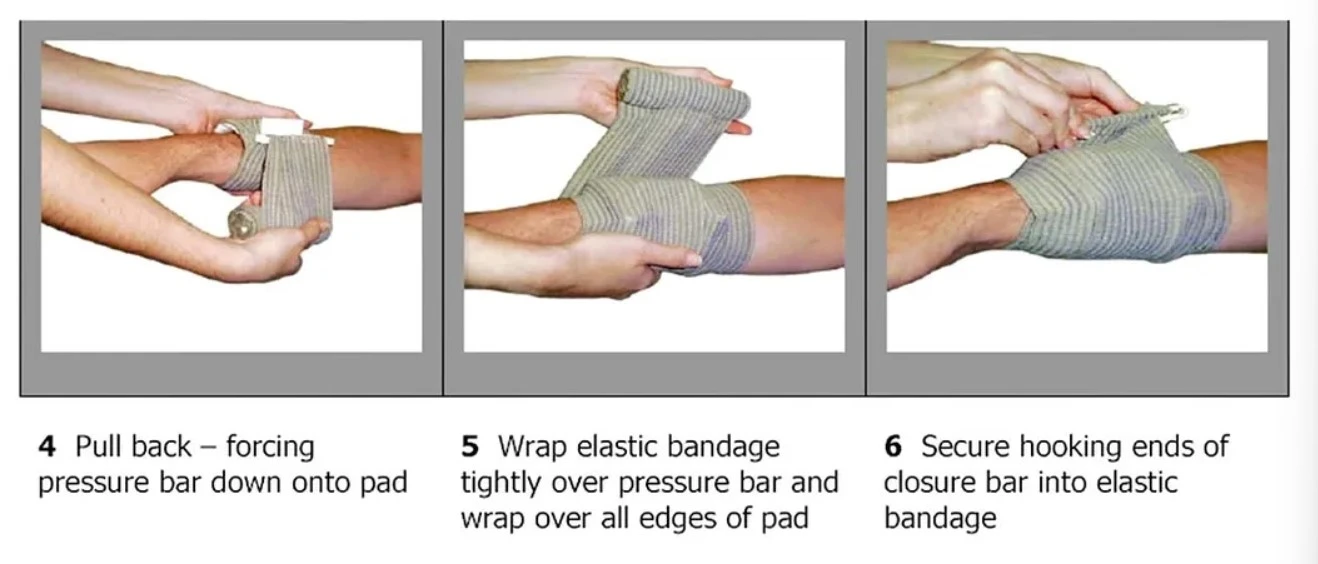 Emergency Bandage Usage Emergency Bandage Usage